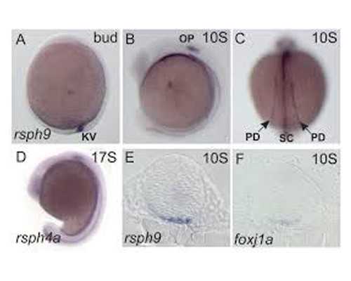 苏州代生咨询，苏州做试管婴儿需要多少钱？