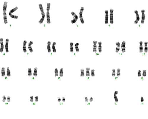 在大连做供卵试管婴儿大概要多少钱？