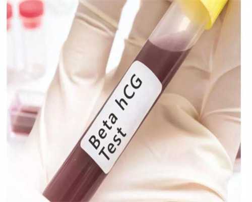 胎位不正应该采用哪种分娩方式