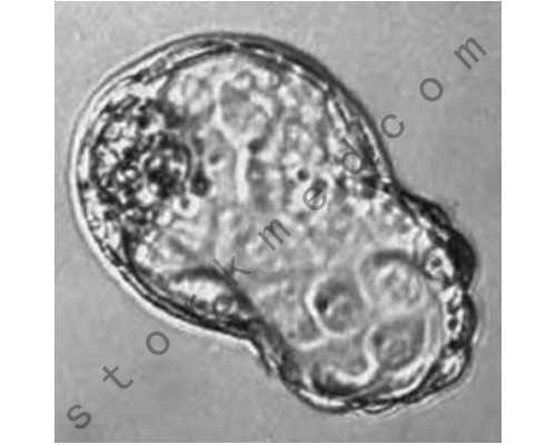河南做代孕靠谱吗,南宁二医院试管靠谱吗？靠不靠谱来看看这些标准达没