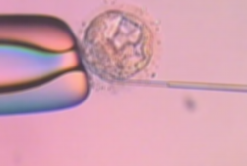 无锡做代生流程，无锡试管婴儿具体收费介绍，全部流程让你一目了然