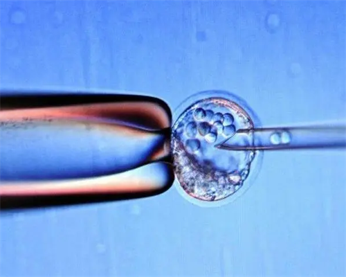 无锡代生怎么联系，无锡旅游去哪里好玩？无锡旅游必去十大景点分享