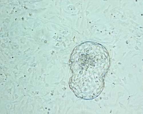 无锡帮人代生费用，〖无锡试管婴儿〗无锡第三代试管南宁