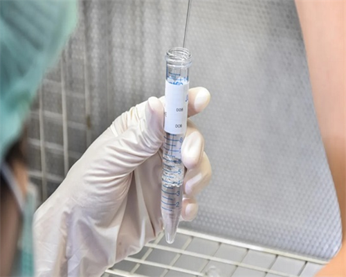 哪个更准？验孕棒和验孕纸大揭秘！