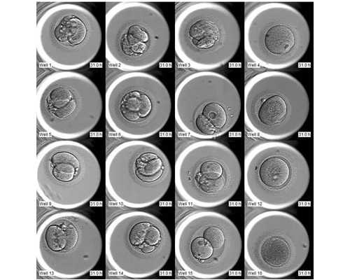 试管婴儿找捐卵代码,单身可以做泰国试管婴儿吗?