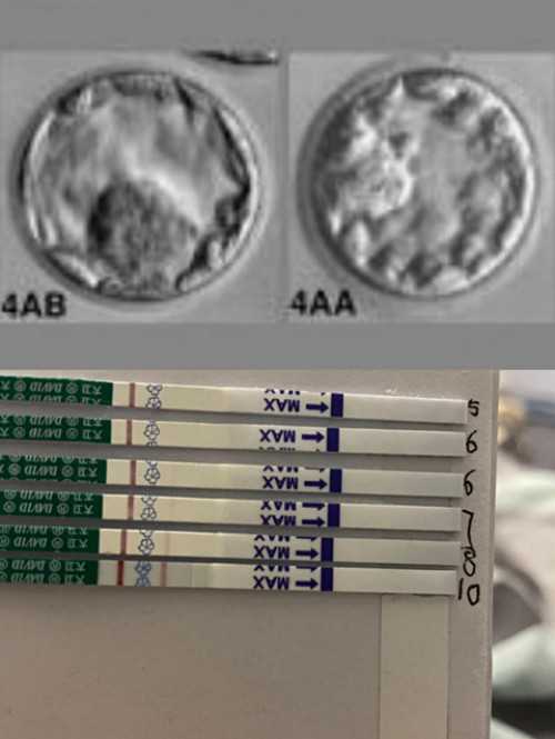 陕西诚信代孕,陕西三代试管医院排名哪家强？陕西三代试管去哪做好？