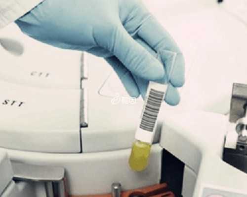 无锡代生大概费用，唐氏筛查需要空腹吗，无锡医院单项费用最低一百八十五