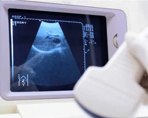 南阳中心医院供卵,【洛阳中心医院供卵吗】做个大大的见证，孕早期HCG孕酮低