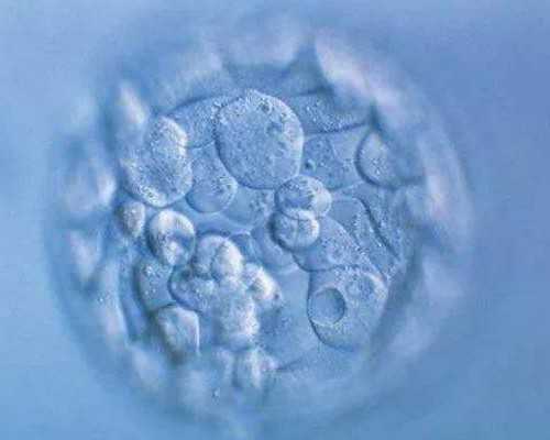 送子鸟医院能做供卵吗，广州供卵试管中心