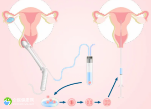 无锡借卵生子技术，盘点无锡市三甲医院