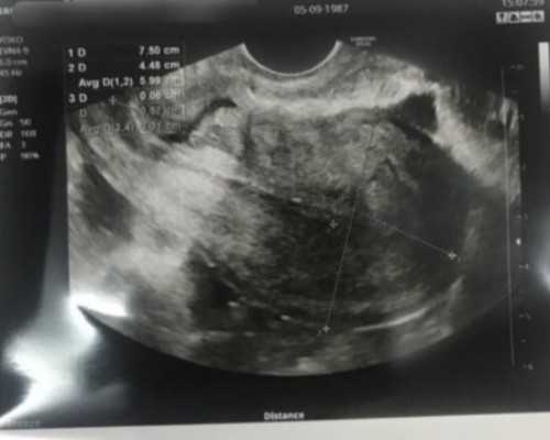 2026长沙供卵试管中心排行更新，4家最受欢迎借卵生子医院名单