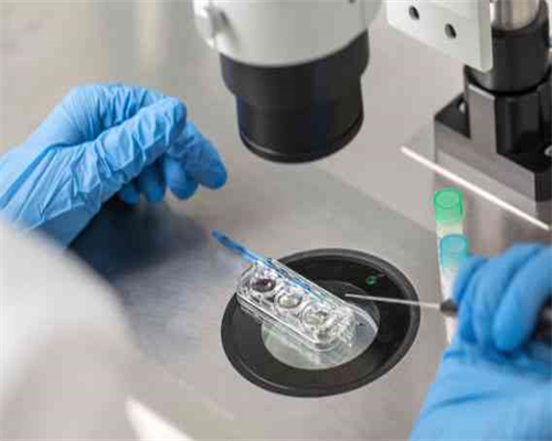 大连冷冻卵子需要多少钱,单身女性冷冻卵子费用