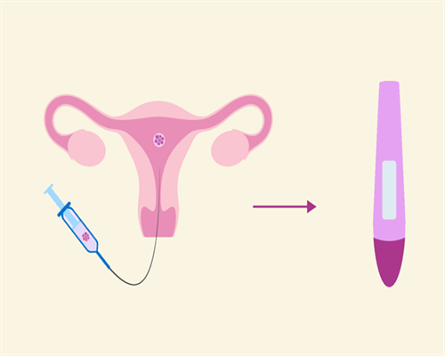 【妊娠糖尿小知识】