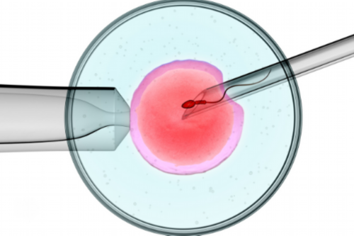 无锡供卵产子包男孩，2026年无锡三代试管婴儿医院哪家好？无锡哪里可以做三