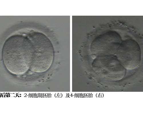 珠海供卵试管机构，珠海借卵做试管