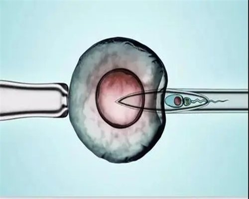 重庆供卵试管费用价格，无卵泡做供卵试管婴儿的费用是多少