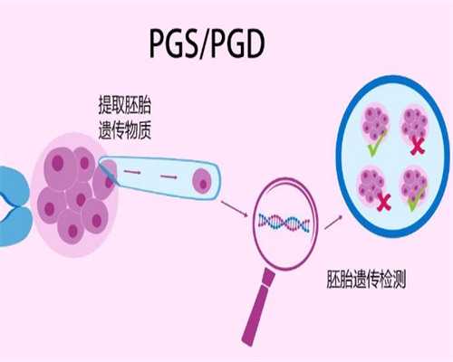 合法无锡供卵，怀孕做唐筛检查去无锡妇幼医院好吗？