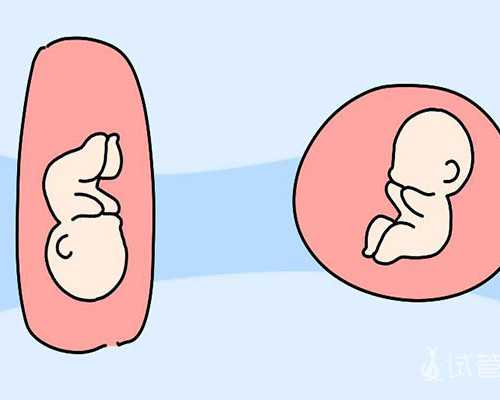 无锡代生包龙凤胎，，无锡试管婴儿医院无锡试管儿医院排名哪家技术好[江苏