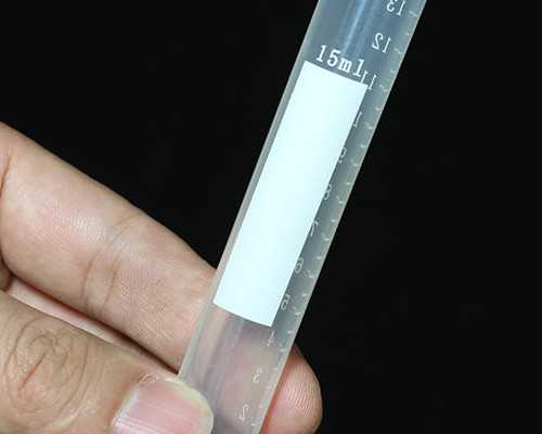 流产以后多久可以做试管婴儿,流产后多久可以去做试管