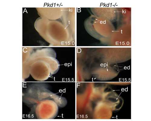 盐城做第三代试管婴儿要多少钱