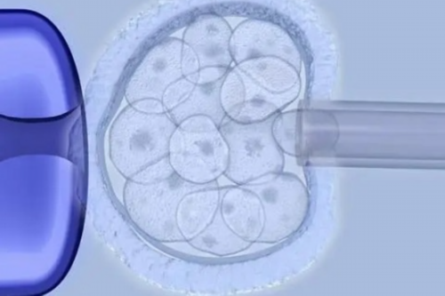 苏州急招捐卵，苏州做试管婴儿_苏州试管宝宝