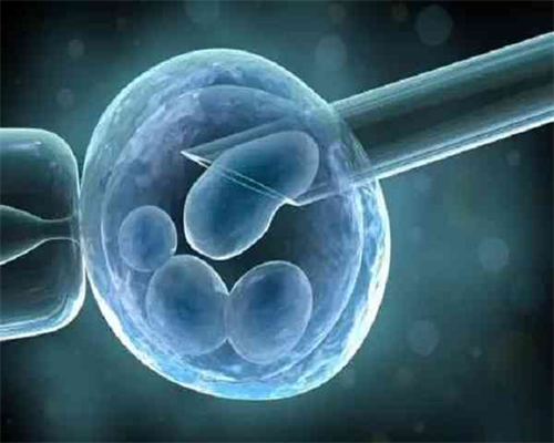 羊水指数正常值