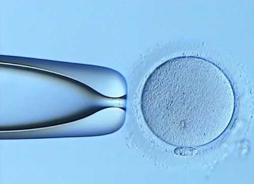 无锡助孕生子价格，无锡试管_无锡市妇幼保健院能做试管婴儿吗