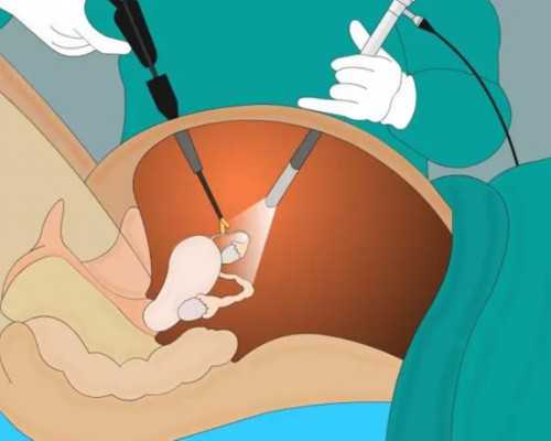 想找无锡人代生，无锡产检假规定