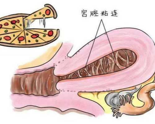 彭献东、陈军玲、李路哪个好？上海集爱试管医生排名奉上