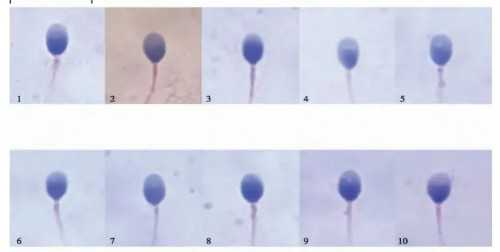 提供无锡代怀孕，无锡试管婴儿医生排名哪位好