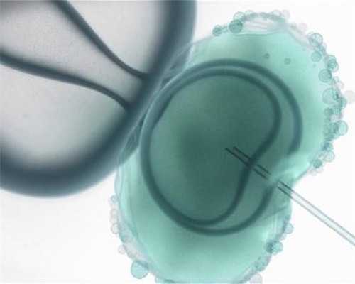 归类分析:美国试管婴儿移植后出现的小状况