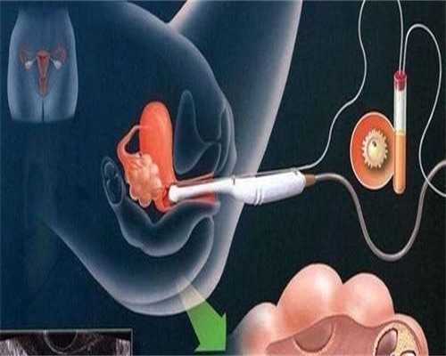 无锡有做试管代怀，无锡吸脂瘦脸的效果怎么样