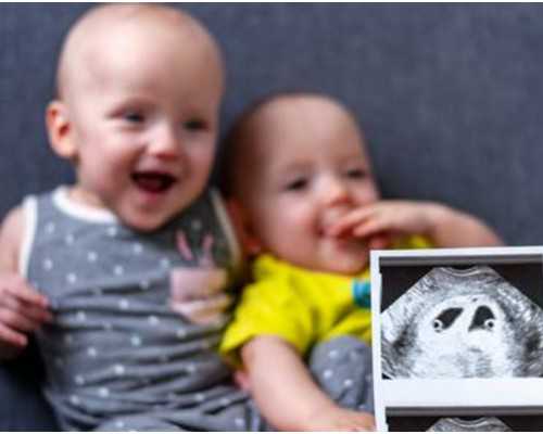 无锡高龄产妇注意事项：无锡高龄产妇注意事项清单