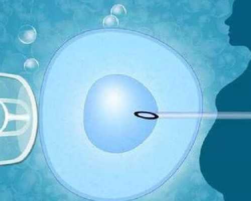 苏州供卵自怀案例，苏州男人头发稀少怎么变浓密？