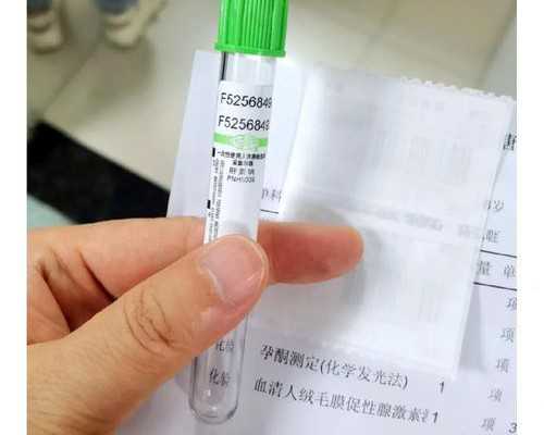 银川赠卵试管婴儿，本地的医院做供卵试管婴儿要排队等多久