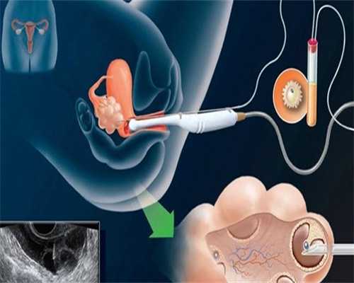 上海试管宝宝生儿子费用，上海试管婴儿费用一般是多少？