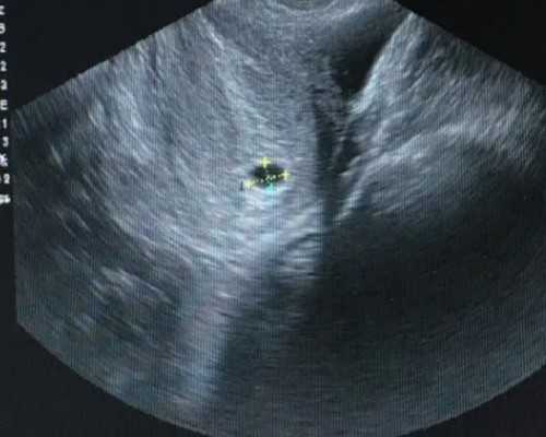 2026青岛大学附属医院试管婴儿成功率一览，附试管婴儿成功率预估表