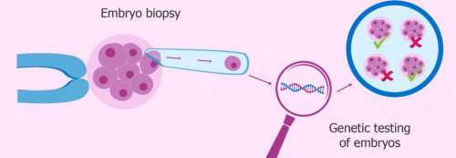 青岛什么引起子宫肌瘤：年轻人子宫肌瘤是怎么引起的