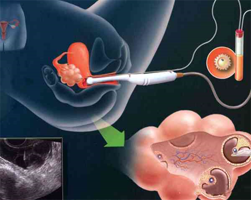 无锡代生怎么联系，无锡旅游去哪里好玩？无锡旅游必去十大景点分享