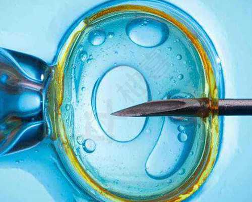 供精试管和供精人授哪个好,供精人工授精的检查