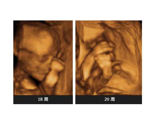 孕妇梦见月亮生男生女