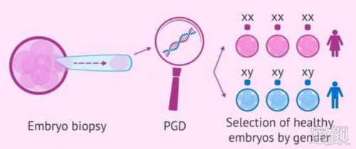 药流残留怎么排出来
