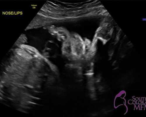 海南去借卵生子多少钱,生孩子需要多少钱-南山去做个内分泌不孕检查多少钱