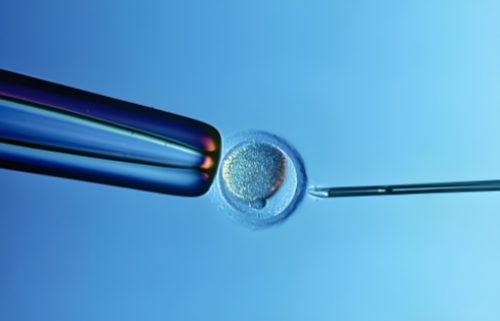 无锡供卵女孩，无锡失独供卵[无锡供卵不排队]