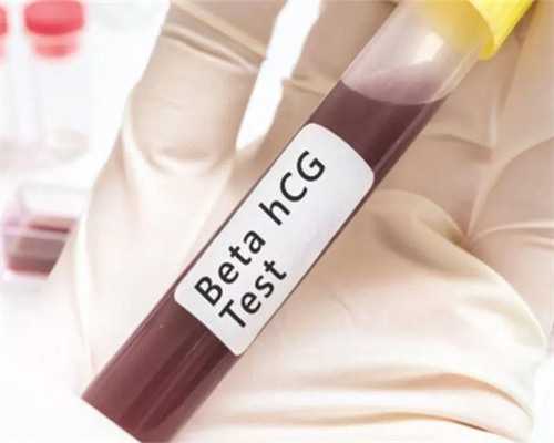 苏州代生联系电话，苏州试管婴儿医院有哪些