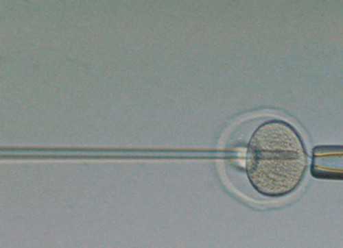 2026深圳市供卵试管生男孩费用一览，附生男孩费用明细介绍