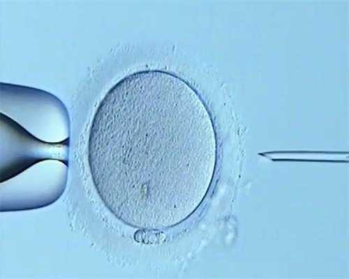 无锡试管供卵条件，无锡试管第三代需要多少费用