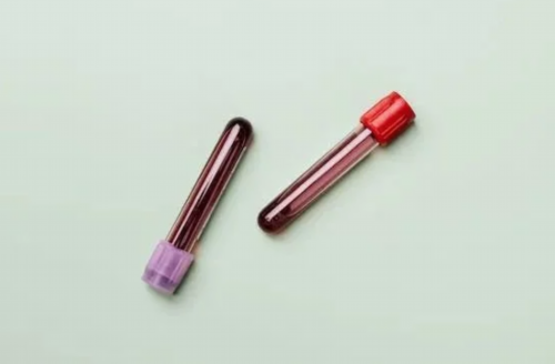 无锡靠谱的供卵机构，无锡吸脂瘦手臂怎么样？