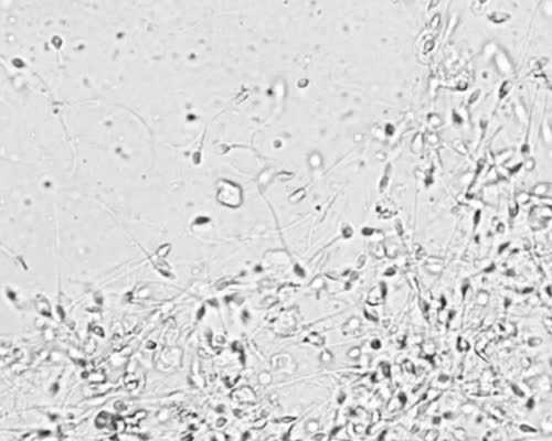 无锡捐卵平台，无锡市试管婴儿_无锡试管宝宝