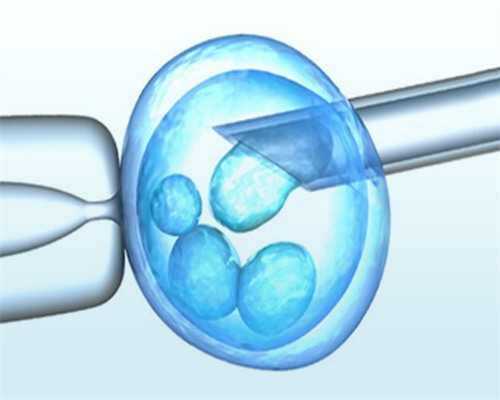 无锡55岁供精供卵，无锡做第三代试管婴儿价格解读！